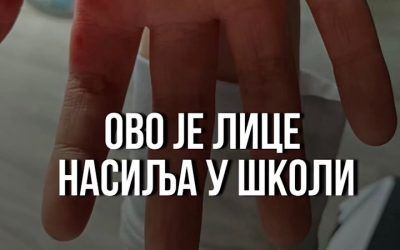 Nasilje u vlasotinačkoj školi: Dečak iz škole izašao sam i krvav, primetili ga ljudi na stanici