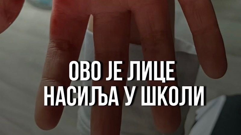 Nasilje u vlasotinačkoj školi: Dečak iz škole izašao sam i krvav, primetili ga ljudi na stanici